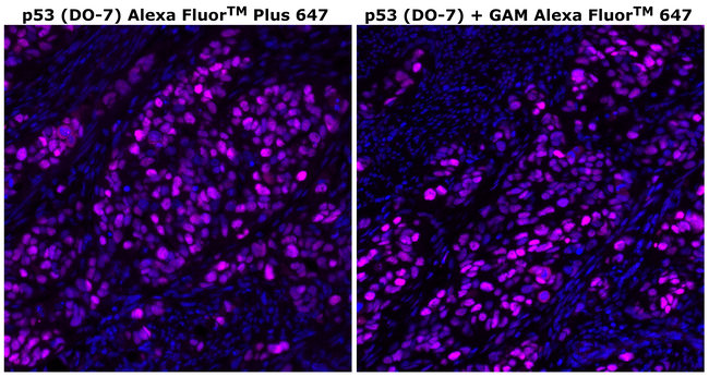 p53 Antibody in Immunohistochemistry (Paraffin) (IHC (P))