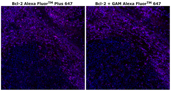 Bcl-2 Antibody in Immunohistochemistry (Paraffin) (IHC (P))