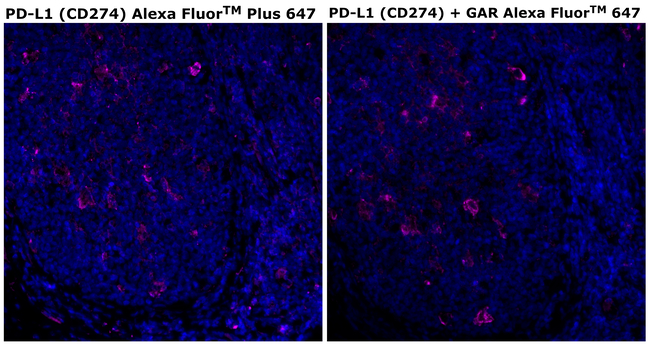 PD-L1 (CD274) Antibody in Immunohistochemistry (Paraffin) (IHC (P))