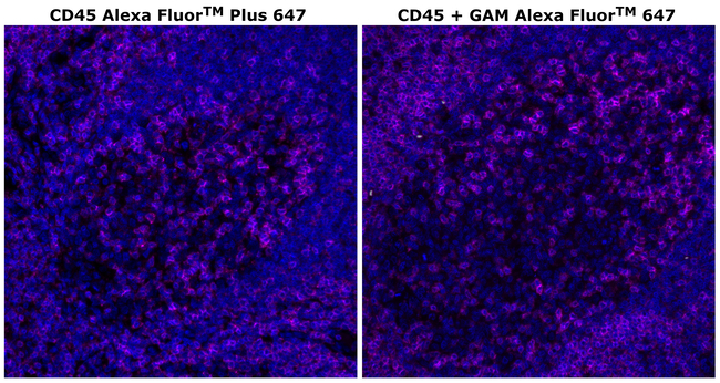 CD45 Antibody in Immunohistochemistry (Paraffin) (IHC (P))
