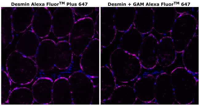Desmin Antibody in Immunohistochemistry (Paraffin) (IHC (P))