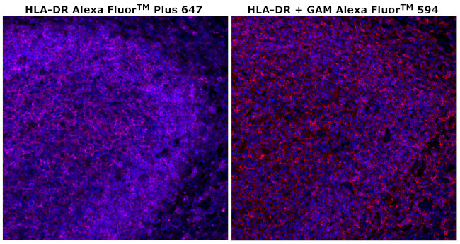 HLA-DR Antibody in Immunohistochemistry (Paraffin) (IHC (P))