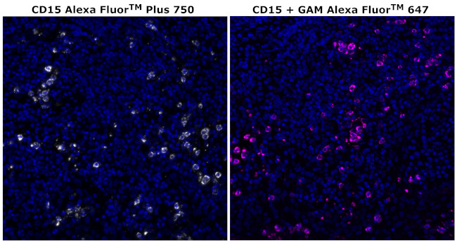 CD15 Antibody in Immunohistochemistry (Paraffin) (IHC (P))