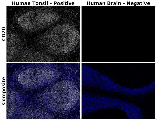 CD20 Antibody in Immunohistochemistry (Paraffin) (IHC (P))