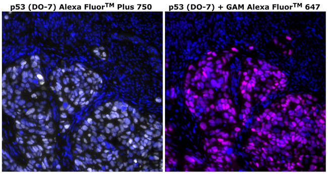 p53 Antibody in Immunohistochemistry (Paraffin) (IHC (P))