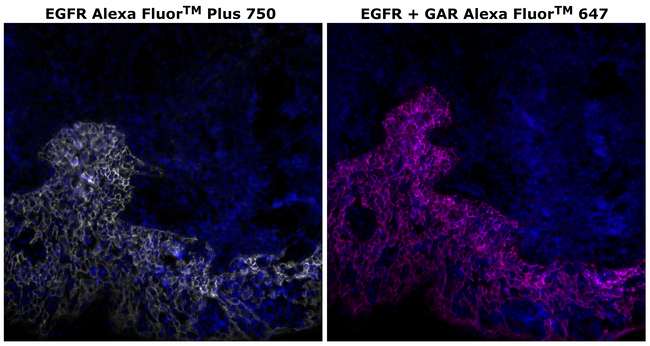 EGFR Antibody in Immunohistochemistry (Paraffin) (IHC (P))