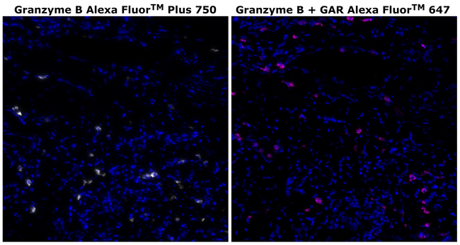 Granzyme B Antibody in Immunohistochemistry (Paraffin) (IHC (P))