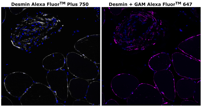 Desmin Antibody in Immunohistochemistry (Paraffin) (IHC (P))