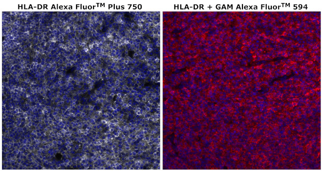 HLA-DR Antibody in Immunohistochemistry (Paraffin) (IHC (P))