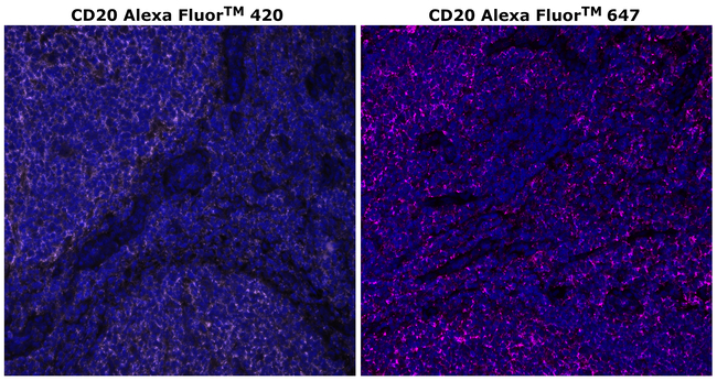 CD20 Antibody in Immunohistochemistry (Paraffin) (IHC (P))