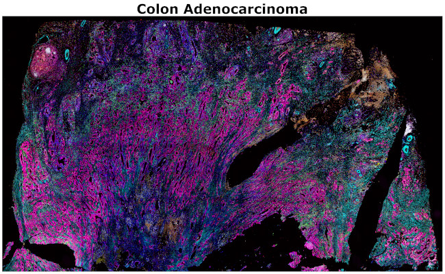 Alpha-Smooth Muscle Actin Antibody in Immunohistochemistry (Paraffin) (IHC (P))