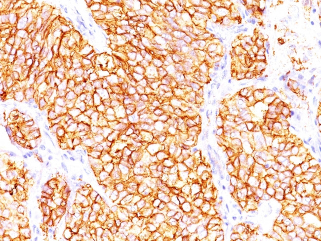 Renal Cell Carcinoma (Carbonic Anhydrase IX) Antibody in Immunohistochemistry (Paraffin) (IHC (P))