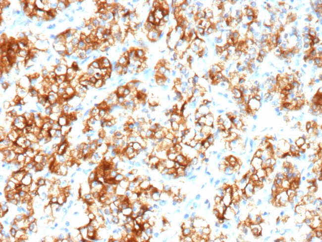Renal Cell Carcinoma (Carbonic Anhydrase IX) Antibody in Immunohistochemistry (Paraffin) (IHC (P))