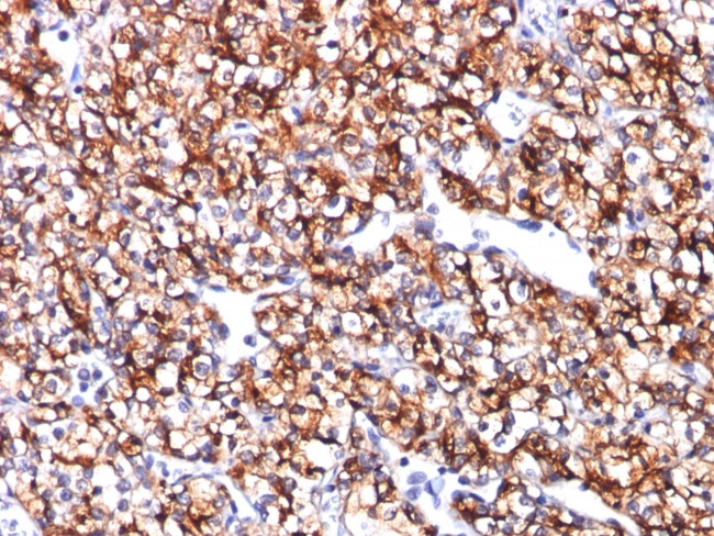 Carbonic Anhydrase IX Antibody in Immunohistochemistry (Paraffin) (IHC (P))