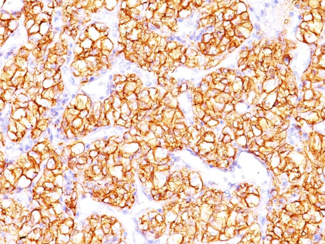 Proximal Nephrogenic Antigen (Carbonic Anhydrase IX) Antibody in Immunohistochemistry (Paraffin) (IHC (P))