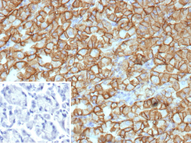 Renal Cell Carcinoma (Carbonic Anhydrase IX) Antibody in Immunohistochemistry (Paraffin) (IHC (P))