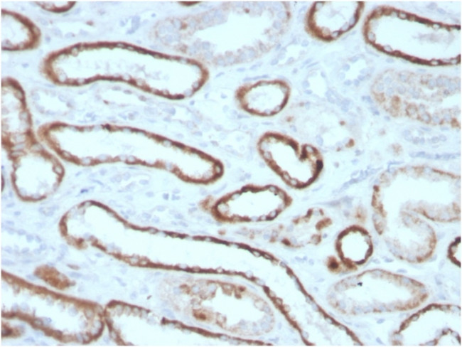 Renal Cell Carcinoma (Carbonic Anhydrase IX) Antibody in Immunohistochemistry (Paraffin) (IHC (P))