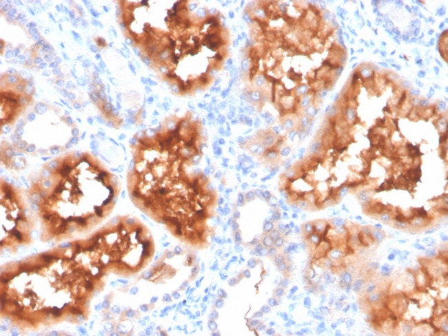 Renal Cell Carcinoma (Carbonic Anhydrase IX) Antibody in Immunohistochemistry (Paraffin) (IHC (P))