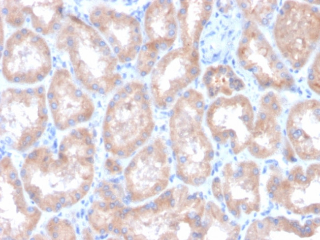 Renal Cell Carcinoma (Carbonic Anhydrase IX) Antibody in Immunohistochemistry (Paraffin) (IHC (P))