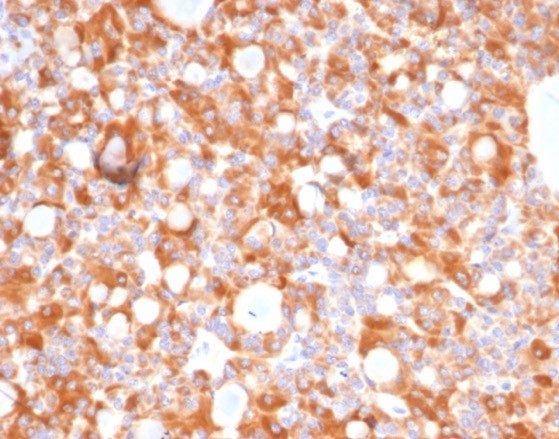Renal Cell Carcinoma (Carbonic Anhydrase IX) Antibody in Immunohistochemistry (Paraffin) (IHC (P))