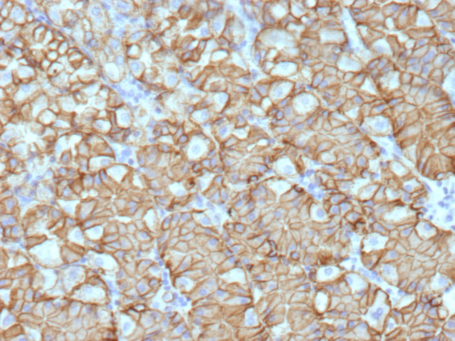 Renal Cell Carcinoma (Carbonic Anhydrase IX) Antibody in Immunohistochemistry (Paraffin) (IHC (P))
