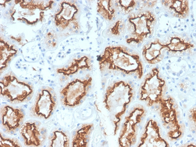 Renal Cell Carcinoma (Carbonic Anhydrase IX) Antibody in Immunohistochemistry (Paraffin) (IHC (P))