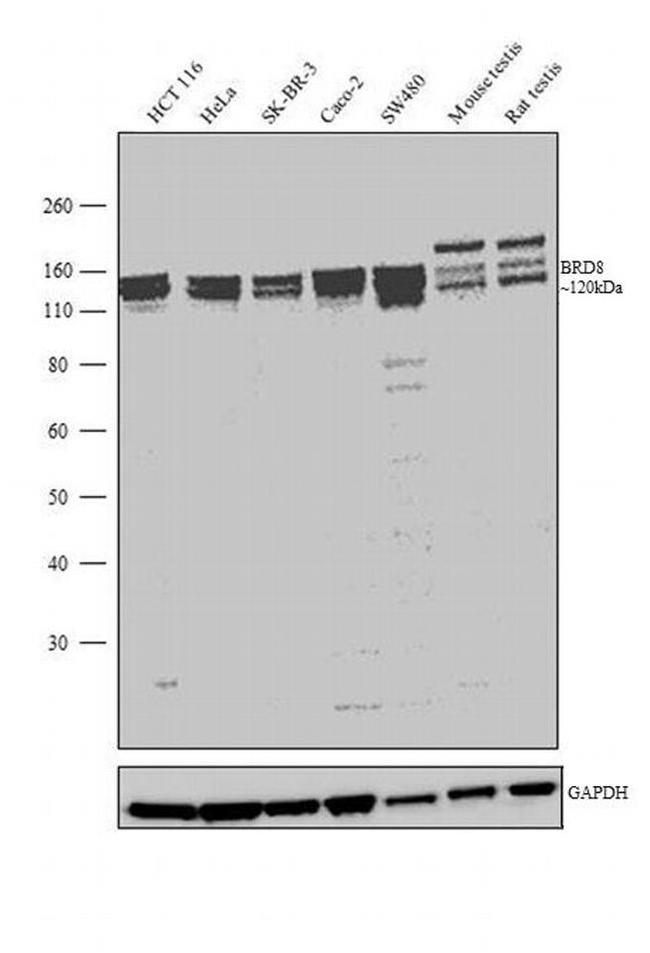 BRD8 Antibody in Western Blot (WB)