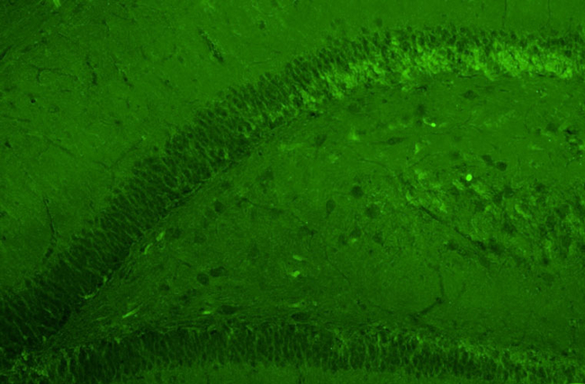 GluN2B/NR2B Glutamate Receptor Antibody in Immunohistochemistry (IHC)