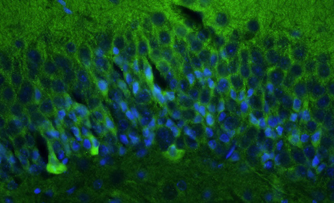 GluN1/NR1 Glutamate Receptor Antibody in Immunohistochemistry (IHC)