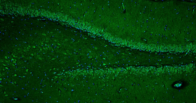 Ryanodine Receptor Type 2 (RyR2) Antibody in Immunohistochemistry (IHC)