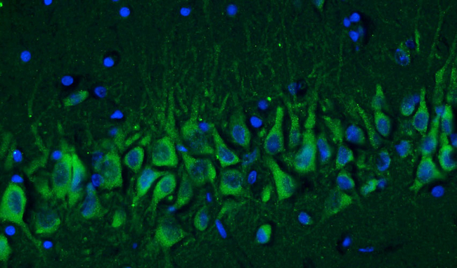 Cav1.2 Ca2+ Channel Antibody in Immunohistochemistry (IHC)