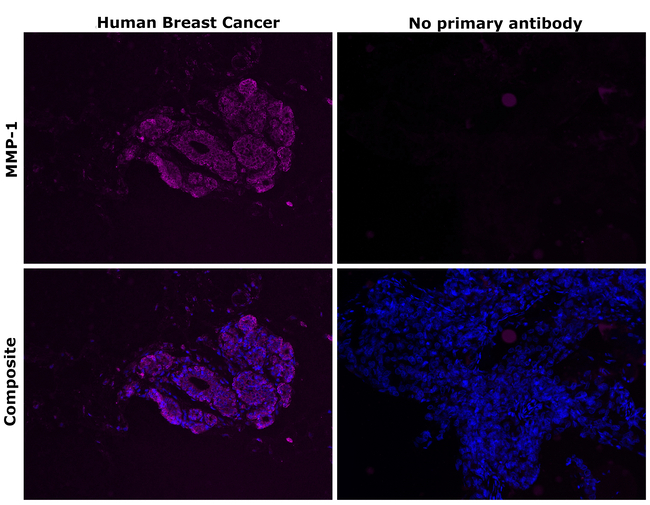 MMP1 Antibody in Immunohistochemistry (Paraffin) (IHC (P))