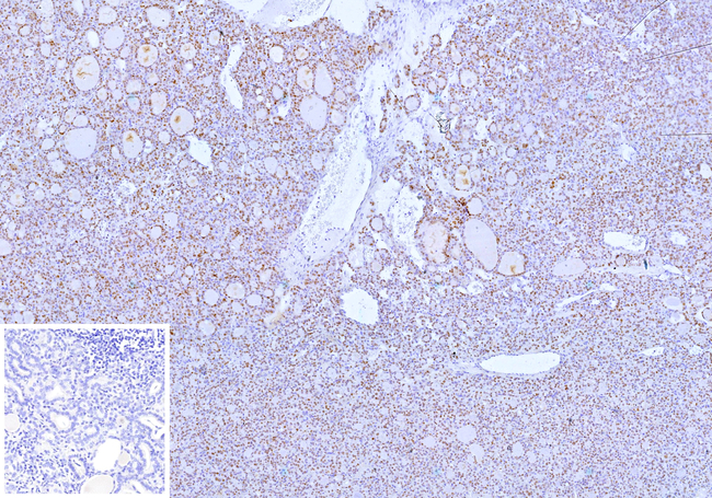 PAX8 (Renal Cell Marker) Antibody in Immunohistochemistry (Paraffin) (IHC (P))