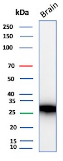 Calbindin 1 (CALB1) Antibody in Western Blot (WB)