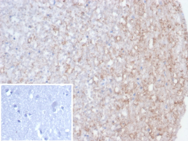 Calretinin/Calbindin 2 (Mesothelioma Marker) Antibody in Immunohistochemistry (Paraffin) (IHC (P))