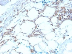 Calretinin/Calbindin 2 (Mesothelioma Marker) Antibody in Immunohistochemistry (Paraffin) (IHC (P))