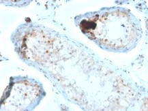 Calretinin/Calbindin 2 (Mesothelioma Marker) Antibody in Immunohistochemistry (Paraffin) (IHC (P))