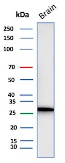 Calretinin/Calbindin 2 (Mesothelioma Marker) Antibody in Western Blot (WB)