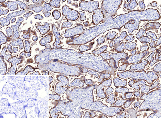 TFPI2 (Marker of Ovarian Carcinoma) Antibody in Immunohistochemistry (Paraffin) (IHC (P))
