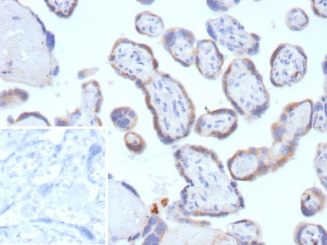 TFPI2 (Marker of Ovarian Carcinoma) Antibody in Immunohistochemistry (Paraffin) (IHC (P))