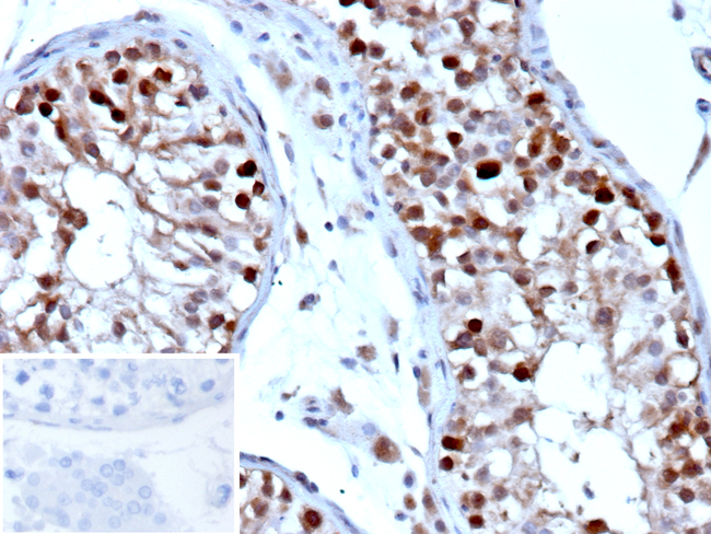 Homeobox protein NANOG (Cancer Stem Cell Marker) Antibody in Immunohistochemistry (Paraffin) (IHC (P))