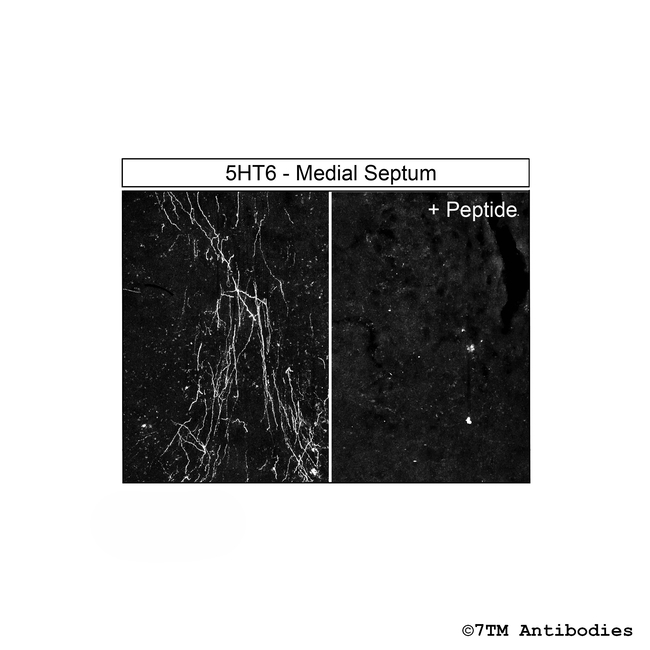 5-HT6, 5-HT Receptor 6 Antibody in Immunohistochemistry (Paraffin) (IHC (P))