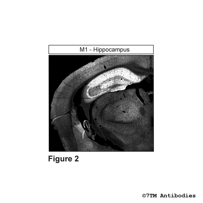 M1, M1 Muscarinic Acetylcholine Receptor Antibody in Immunohistochemistry (Paraffin) (IHC (P))