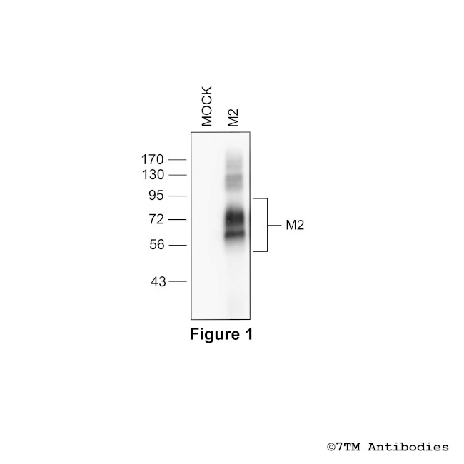 M2 (M2 Muscarinic Acetylcholine Receptor) Antibody in Western Blot (WB)