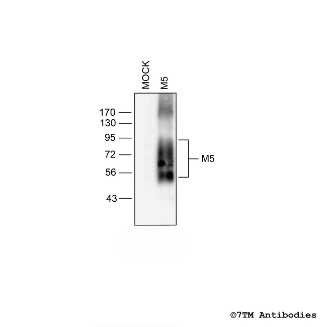 M5 (M5 Muscarinic Acetylcholine Receptor) Antibody in Western Blot (WB)