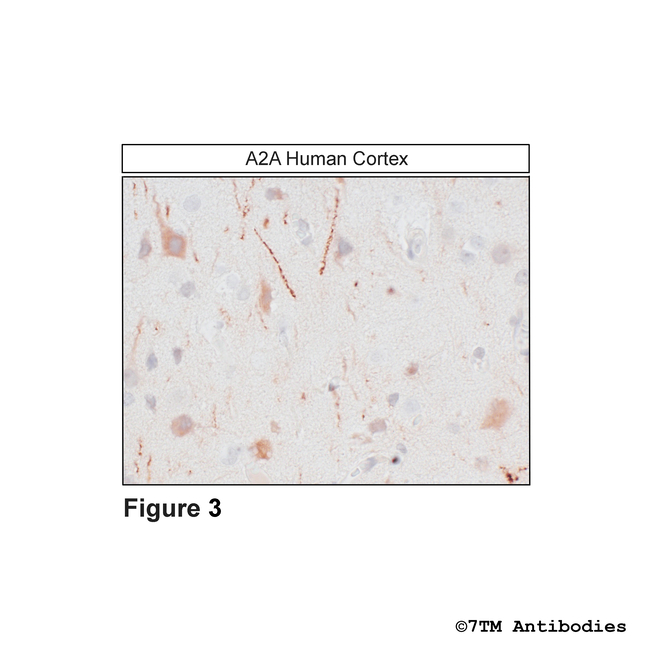 A2A, Adenosine 2A Receptor Antibody in Immunohistochemistry (Paraffin) (IHC (P))