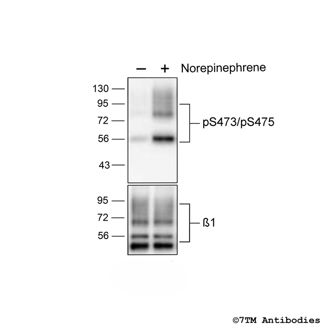 Phospho-beta-1-Adrenoceptor (Ser473, Ser475) Antibody in Western Blot (WB)