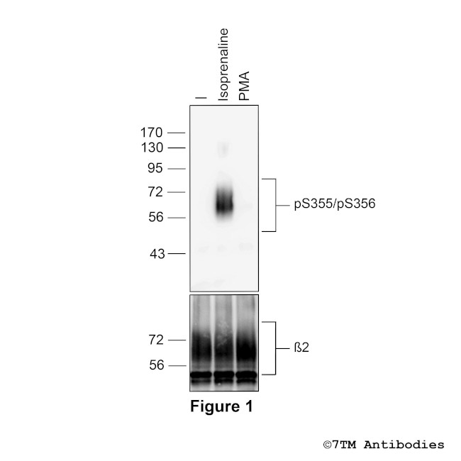 Phospho-beta-2-Adrenoceptor (Ser355, Ser356) Antibody in Western Blot (WB)