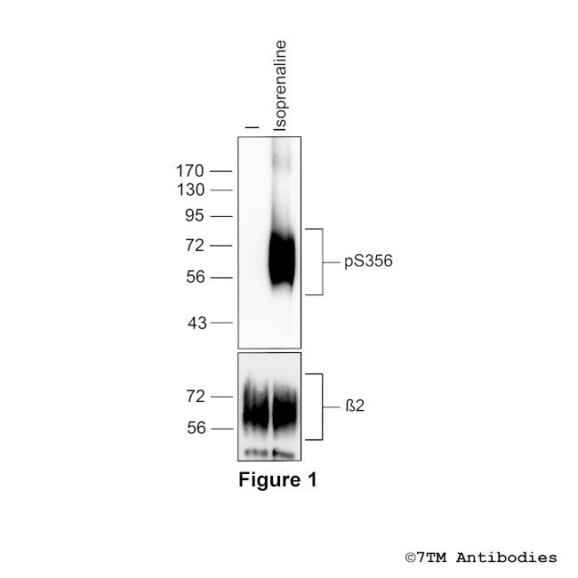 Phospho-beta-2-Adrenoceptor (Ser356) Antibody in Western Blot (WB)