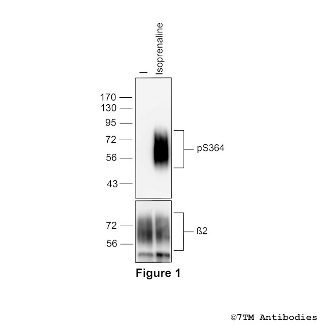 Phospho-beta-2-Adrenoceptor (Ser364) Antibody in Western Blot (WB)